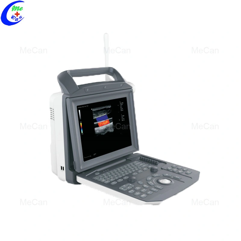 Portable Full Digital Portable 4D Color Doppler Ultrasound Scanner Machine