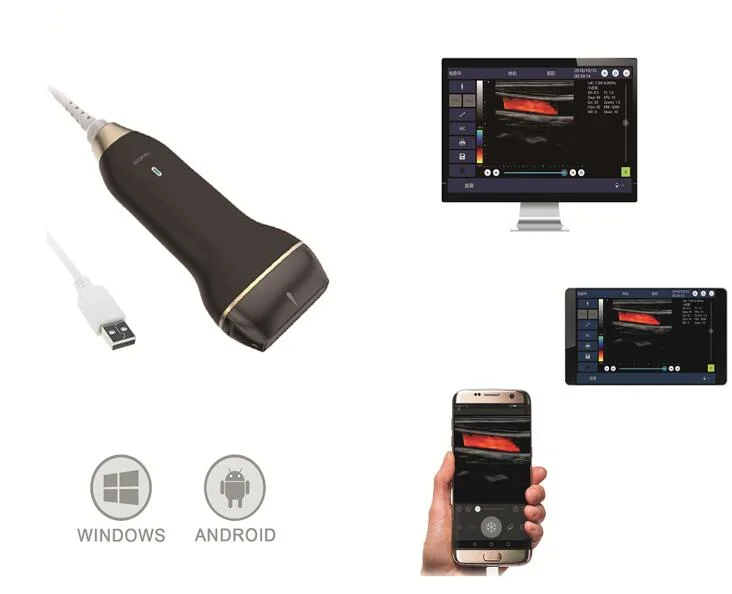 Lower Price USB Smartphone Echographe Portable Ultrasound Machine/Probe/Scanner