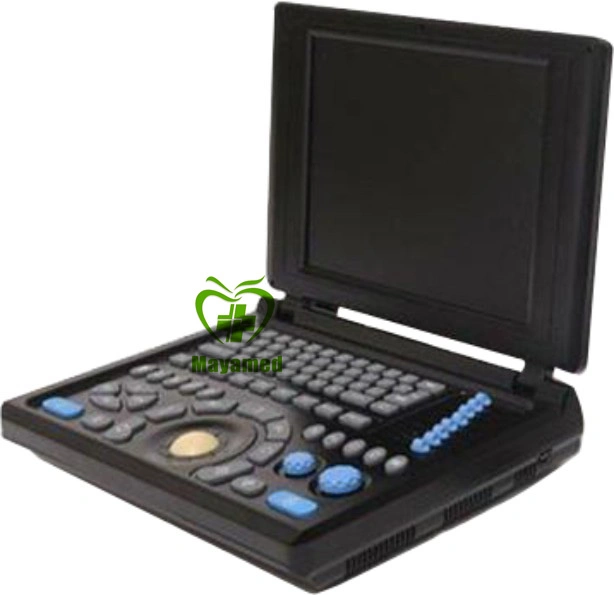 Medical Diagnosis Equipment Laptop Color Doppler Ultrasound Scanner